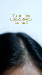 Selsun Gold 60ml/120ml/200