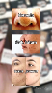 Sabun Flek Hitam Paling Ampuh & Asli Original