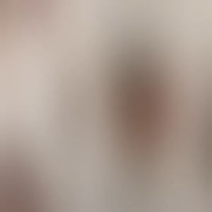 Bracket Kaca Spion Nissan Livina L10 2006-2012