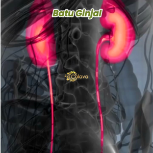 Teh Herbal Colava Batugin: Solusi Alami Untuk Luruhkan Batu Ginjal & Mencegah Pembentukan Kembali