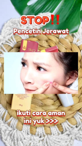 ACNE Totol SR12  mengatasi jerawat