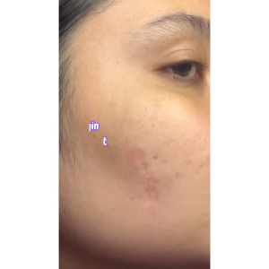 (glass skin bundle) GLOW FX 17% total acids ceracapsule peeling solution - serum exfoliasi wajah mengandung glycolic acid untuk mencerahkan dan menghaluskan wajah