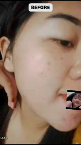 (Ready) SERUM ALL YEENKA BEAUTY BPOM