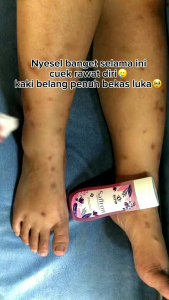 Toner badan saffron aleya untuk bekas luka bekas koreng atau lipatan lainnya herbal alami BPOM 100% Original