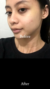 Prestige Niacinamide Soap 10x Whitening Firming and Moisturizing Face and Body Soap