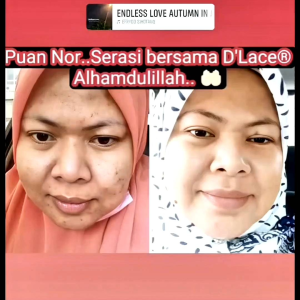 DLACE DELUXE BOOSTER SERUM