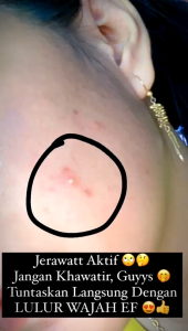 Lulur Wajah Ekha Feris Mencerahkan