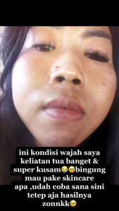 Day Cream Brightening Platinum + Serum Rejuvenation Orlin Beauty / Paket Best Couple di pagi hari / Skincare bpom (free gift cantik)