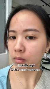 Dr. Ora AURA WHITE ULTRA Skin Whitening Supplement / Anti-aging / Brightens skin /Lightens Dark Spots / Whitening UV Protection Beauty Supplement 5g x 30s [Multi Award Winning]