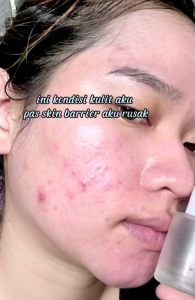 RK SERUM ORIGINAL (GARANSI UANG KEMBALI )