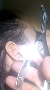 1 kẹp mở rộng taihỗ trợ lấy ráy tai chất liệu inox 304 không rỉ  an toàn khi sử dụng ngành ráy tai