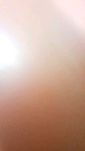 lintahset lintah bekamleeches therapy