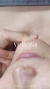 ACNE CLEAR AMPOULE GSC