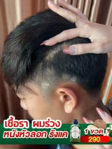 Anyaa แชมพู+ทรีทเม้นต์ 490.- พญายอพลูคาว ร่มปริมาณ 80 ล้านม.,สมุนไพรไทยแท้100% สำหรับจบทุกปัญหาเรื่องผิวหนัง
