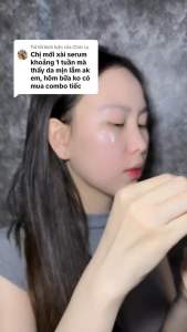 COMBO 3 món mini: 1 FACE QUEEN + 1 SERUM MESO + 1 CHỐNG NẮNG FAIRY Hỗ trợ dưỡng trắng mờ thâm cấp ẩm căng bóng chống lão hoá se khít lỗ chân lông phục hồi da chống nắng (tặng 1 Sữa Rửa Mặt mini + 1 Cấy Trắng + 1 Kẹp Tóc)