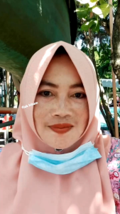 LAYNA PAKET ULTIMATE AHA | PAKET FLEK HITAM