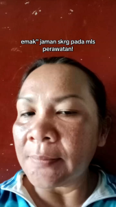 Free Gift | LAYNA NIGHT CREAM ULTIMATE FLEK