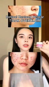 [ BEST SELER PELICIN ] THE RIDE BEAUTY SALEP PELICIN WAJAH JELLY BOSTER PELICIN  PENCERAH WAJAH AMPUH FLEK HITAM SUSAH PUTIH BPOM