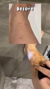 paket sabun beras hitam dan lulur hitam original 100 gr bedda lotong mabelo beda lotong beda lotong BPOM