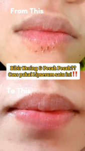 Lip Serum Amr Glow / Glow Pink Lip Serum By AMR GLOW SKINCARE / Lipbalm / Lipserum Amr