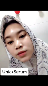 Paket Glowing UNIC SKINCARE + Red Jelly + Serum: Paket Bundling Perawatan Kulit Lengkap