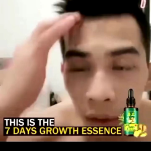 Serum Penumbuh Rambut Rontok 7 Hari