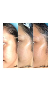 เซรั่มรังนก เซรั่มเนสท์มี nestme เนสท์มี เบิร์ดเนสท์ แอนตี้-เมลาสม่า ไวท์เซรั่ม