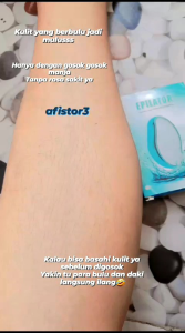 epilator crystal hair removal alat penghilang bulu nano