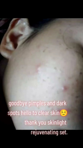 Skinlight Rejuvensting set