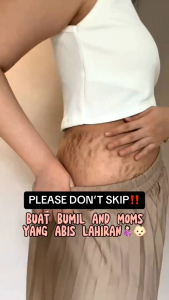 Lotion Penghilang Strechmark & Selulit Cepat & Permanen Setelah Melahirkan