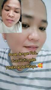 TONER BIALWBI EXSTRA LEMON TONER PELICIN STRONG BPOM ORIGINAL