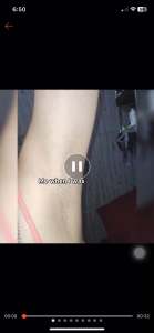 DARE TO BARE HAIR REMOVAL CREAM: An Effective & Convenient Solution