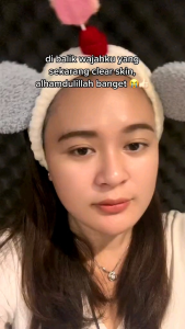 PAKET KYMM SKIN ANTI ACNE 4PCS | FREE POUCH FACEWASH BAKUCHIOL SERUM EFFORTLESS SUNSCREEN ACNE SPOT GEL