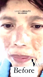 VANESABEAUTY SKINCARE whitening