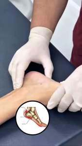 SERUM HALIA BENTONG MUSLIMHERBS PLUS SACHA INCHI & DAUN BIDARA ESSENTIAL OIL