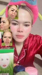 (CHÍNH HÃNG ) Kem thảo dược meiyong thái Lan đặc trị mụnnámtàng nhanđốm đenđồi mồi hiểu qua hàng chính hãng