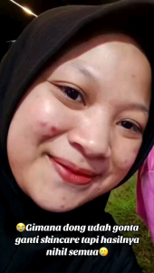 Orlin Beauty Paket ACNE GLOWING Mengatasi Jerawat Bandel Bopeng Ampuh Menyembuhkan Jerawat