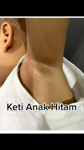 New glowby skin serum pencerah kulit anak pemutih kulit mencerahkan kulit glowby skin original glowby skin asli.