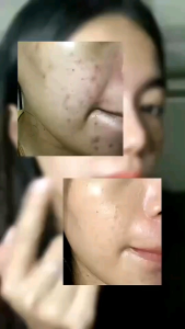 SERUM NSY SCAR BOPENG/JERAWAT/FLEK/ ANTI AGING / BRIGHTENING MEMUTIHKAN BPOM 30ML