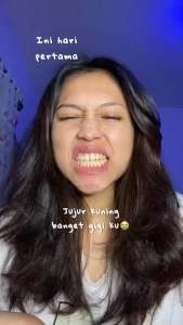 READY Go Smile Dental White Patch Bleaching Gigi Instan Auto Putih - Untuk Memutihkan Gigi seperti Bleaching dengan Glycerin Menthol dan PVP [BPOM]