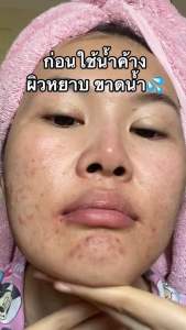 Dewellness น้ำค้าง beauty water 180 ml ลดสิว ผิวใสเป็นกลาสสกิน