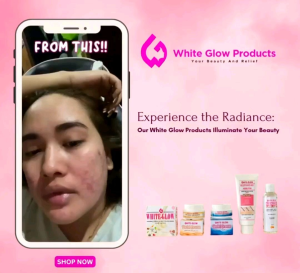 White Glow Soap 12pcs: Cleansing & Glowing Skin