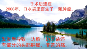 Japan  Multipurpose Negative Ion Inner Cap