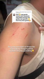 [20pcs] Milky Gluta 50x Whitening Scar Remover Whipped Soap – Brightens Skin Fades Scars Evens Skin Tone & Softens for Face & Body – 70g each