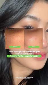 Emina Natura Pal Gel Moisturizer 20 ML - Pelembab Wajah Untuk Memperbaiki Skin Barrier