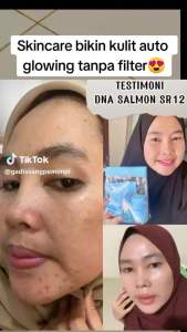 DNA Salmon skincare BPOM Series SR12 4in1 Wajah Cerah Glowing