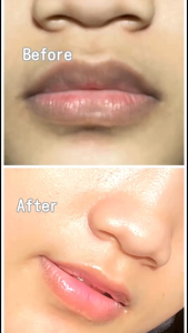 Noera Vita Lip Serum | Serum Bibir Pemerah Pencerah Bibir Pink Alami