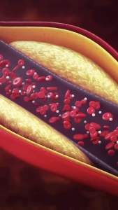 ไขมันในเลือด ความดัน ลดไขมัน โคซานอล ขนาด 30 แคปซูล