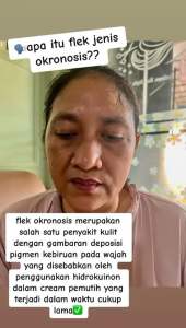 [FREE BONUS MENARIK]BONUS PAKET FLEK PLATINUM + SERUM ANTI AGING MEMUDARKAN FLEK MEMBANDEL FLEK OKRONOSIS FLEK MELASMA KRIM PEMUTIH CREAM RACIK KRIM FLEK SKINCARE VIRAL