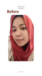 MK SKIN FREE SUNSCREEN PAKET WHITENING MAMPU MENCERAHKAN WAJAH